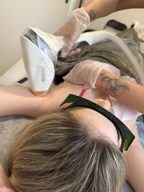 Лазерна епіляція, London Beauty Hub Львів